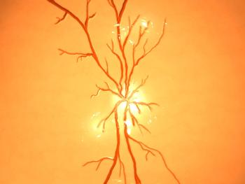 What attendees can expect at the 2021 virtual Angiogenesis meeting