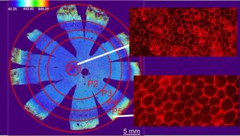 Retinal cell map sheds light on tissue targeted by AMD, may advance precise therapies for disease