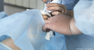 anxiety over eye injections