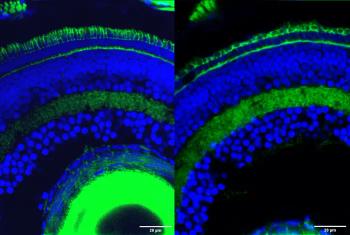 Gene fragments revealed play crucial role in retinal development and vision