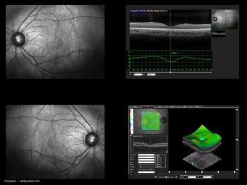 Image Credit: ©Jevgenij - stock.adobe.com