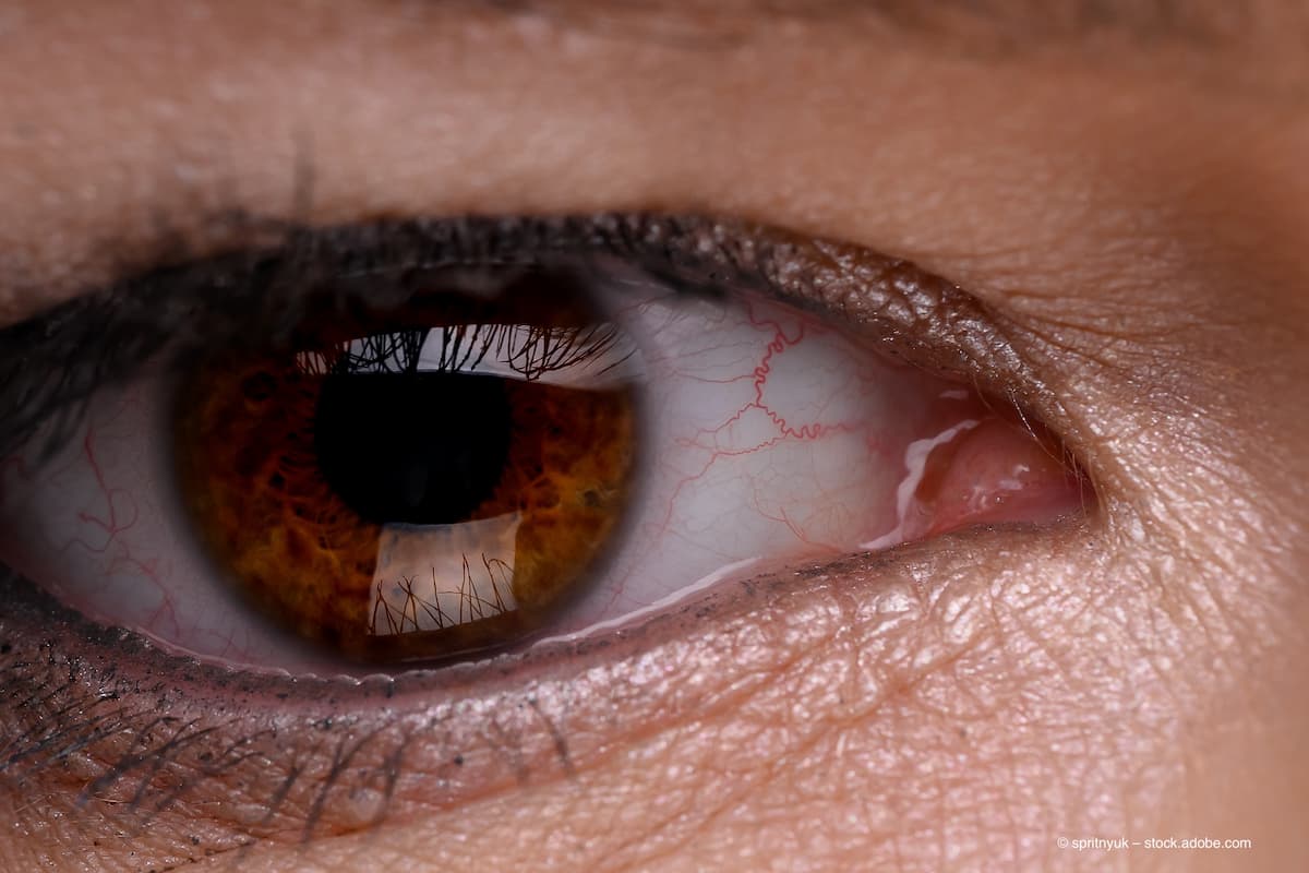 Multidisciplinary insights into diagnosing tubulointerstitial nephritis, uveitis