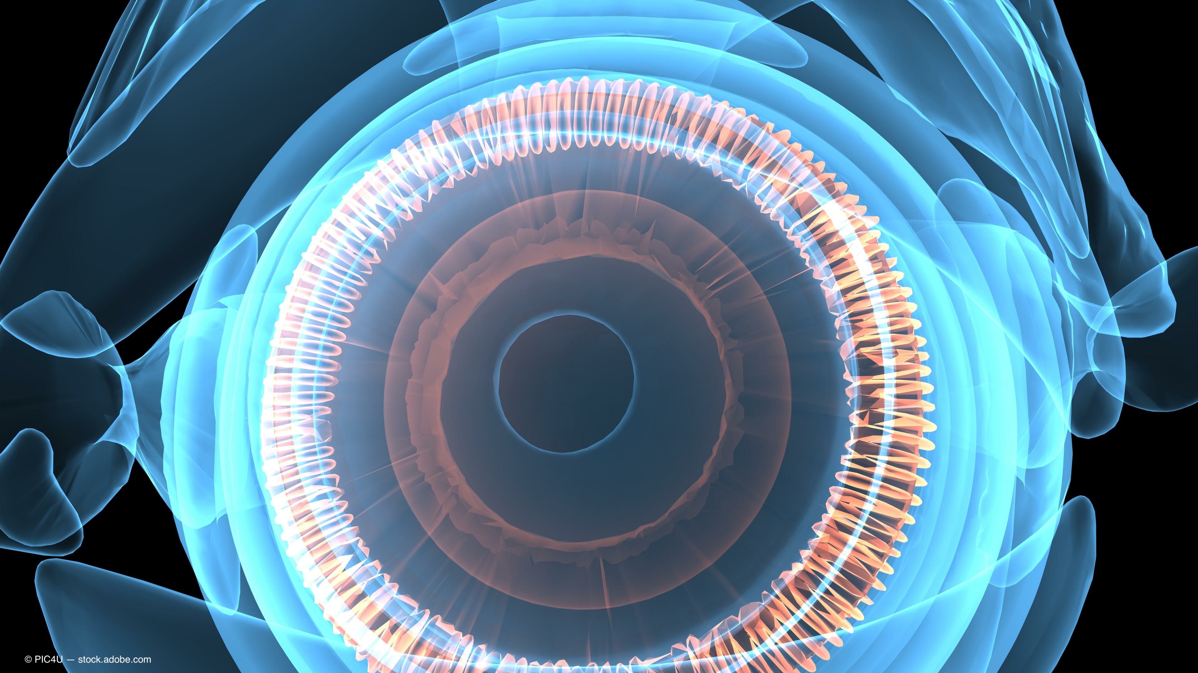 Aflibercept broadly effective for reducing DR severity in post-hoc analysis 