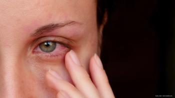 Sustained-release anti-inflammatory therapy is valuable in noninfectious uveitis