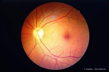 diabetic retinopathy