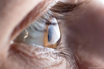 Increase in corneal haze after corneal crosslinking caused by mitomycin C