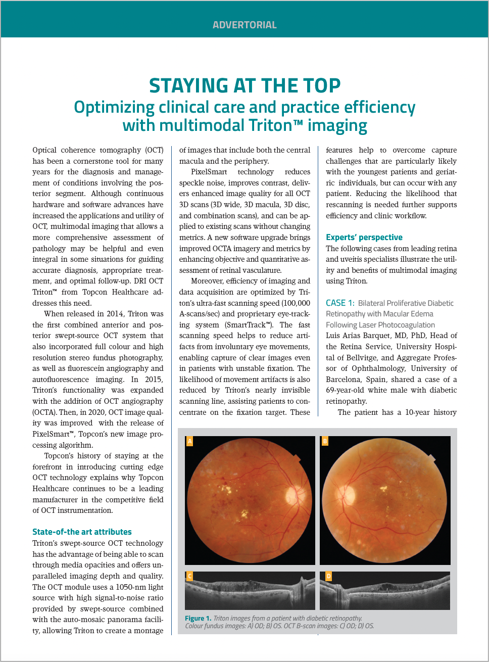 Retina Workflow