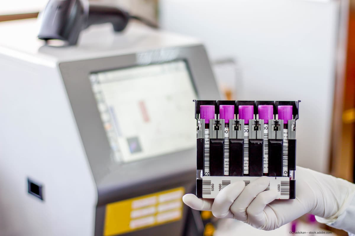 New tool emerges for predicting the risk of vision loss from diabetic retinopathy