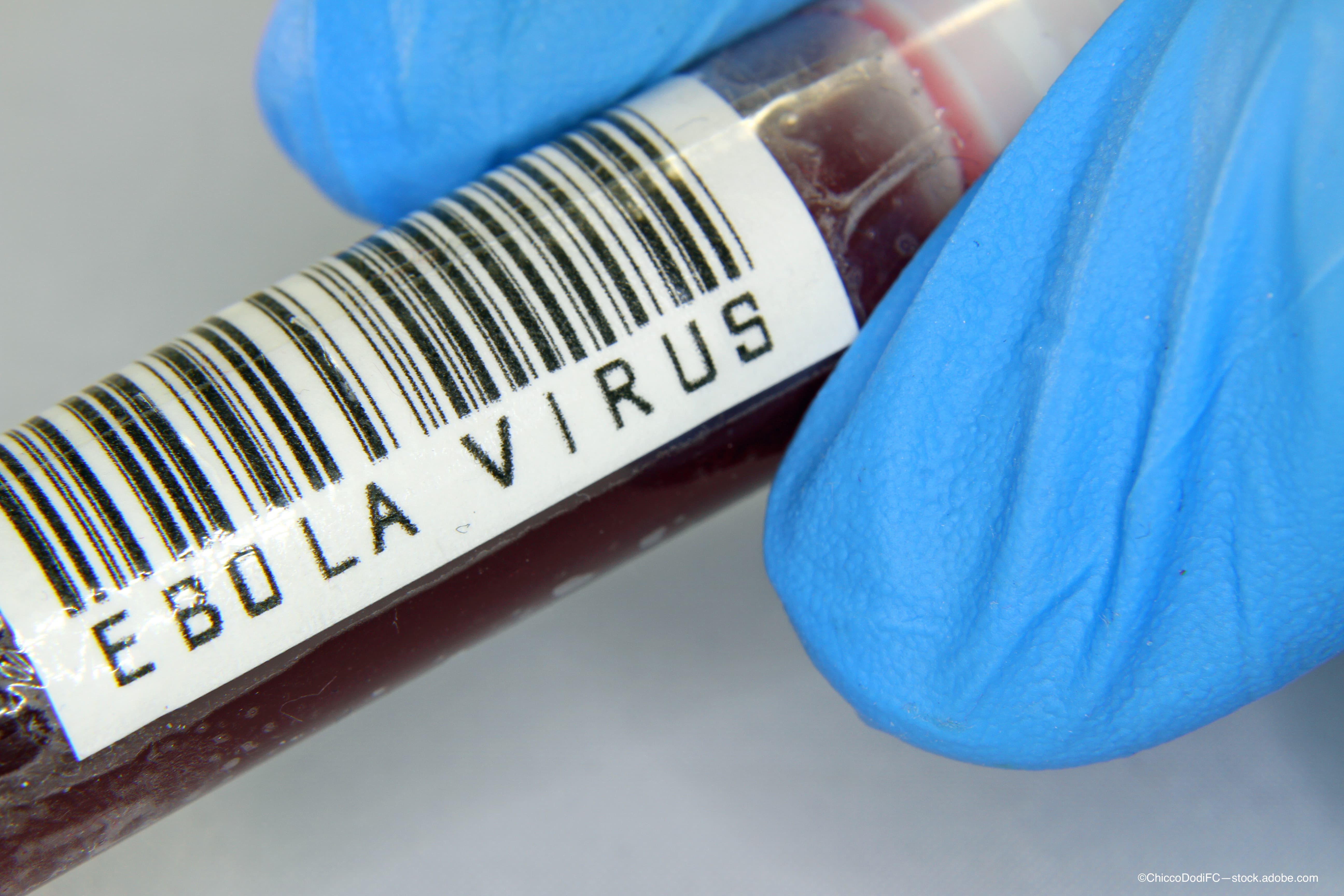 Retinal cells may house Ebola, other viruses