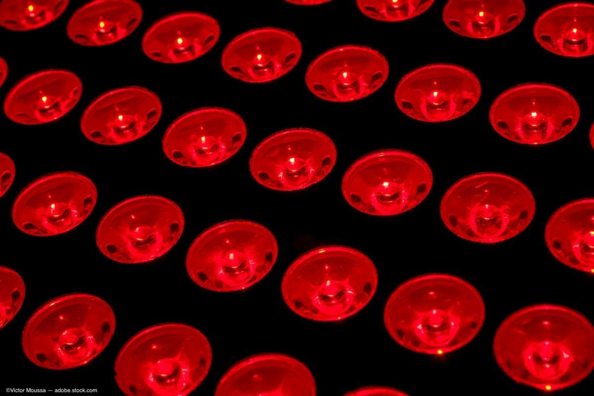 ©Victor Moussa / stock.adobe.com