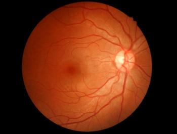 Devic disease