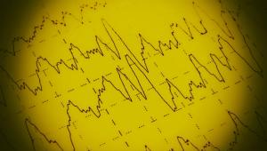 5 Important Facts About SUDEP