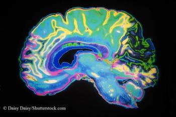 brain MRI scan