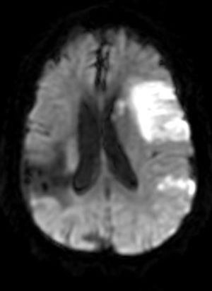 What Caused Altered Consciousness in This Middle-Aged Woman? 