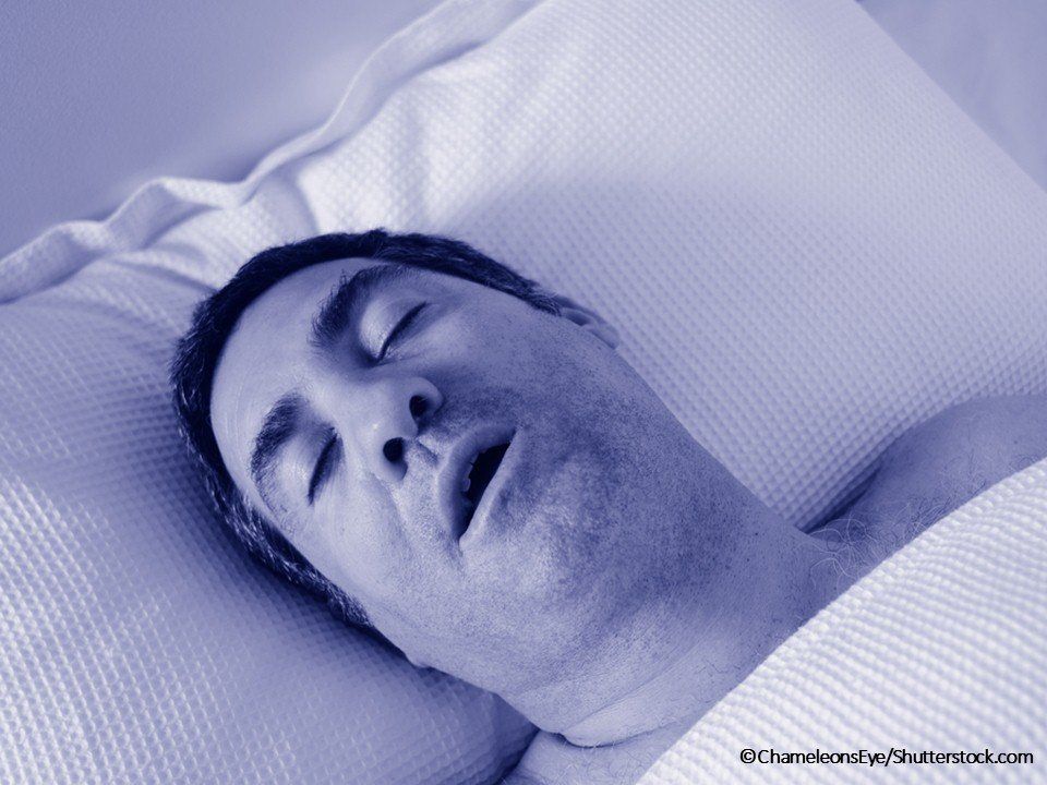 sleep apnea snoring man