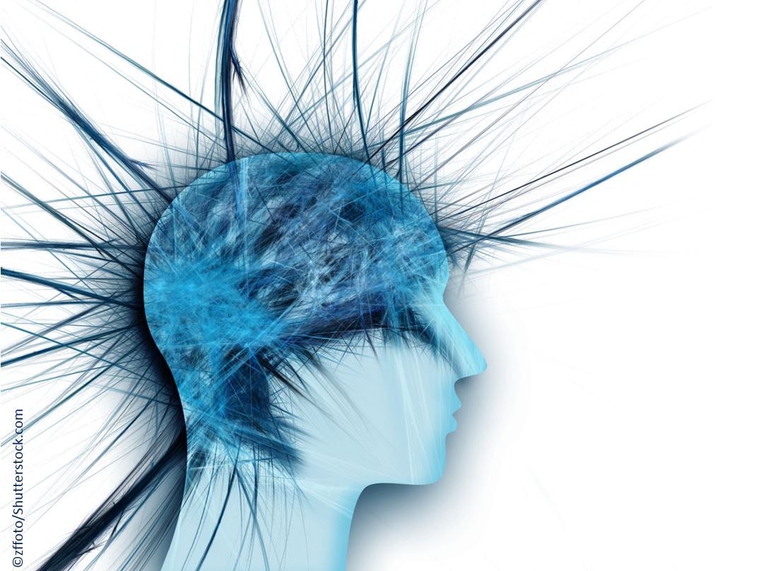 neuralgia