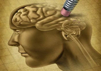 Alzheimer disease