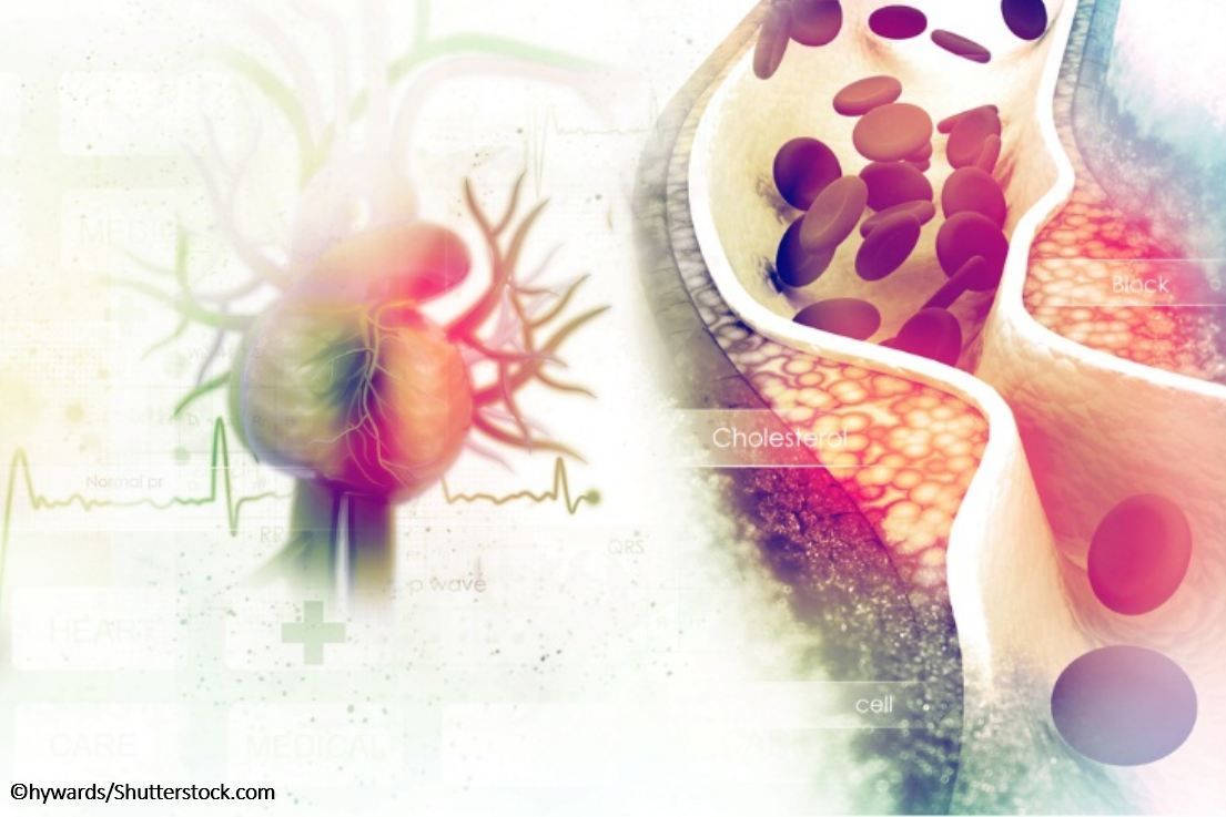 heart cardiovascular disease blood vessel