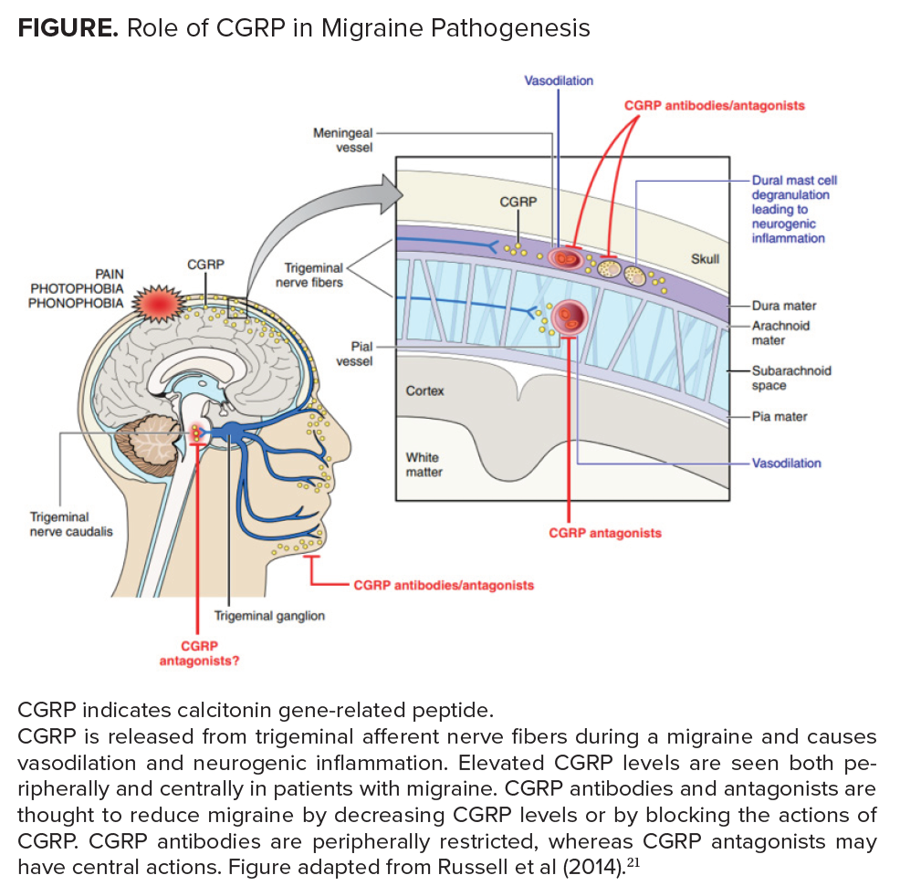CGRP: Paving the Path to Migraine and Its Treatment