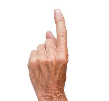 Parkinson vs Alzheimer Dementia: A Clinical Sign