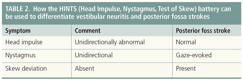 Top 5 CNS Causes Of Dizziness