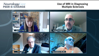 Use of MRI in Diagnosing Multiple Sclerosis