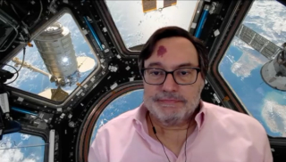 RISE-PD Study of IPX-203 in Parkinson Disease: Robert A. Hauser, MD, MBA