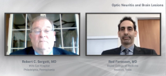 EP. 2 Optic Neuritis and Brain Lesions