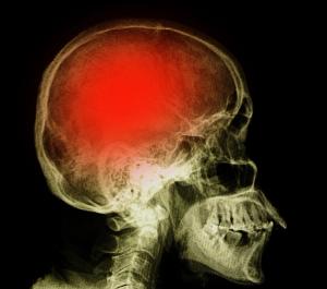 ©Tewan Banditrukkanka/Shutterstock.com