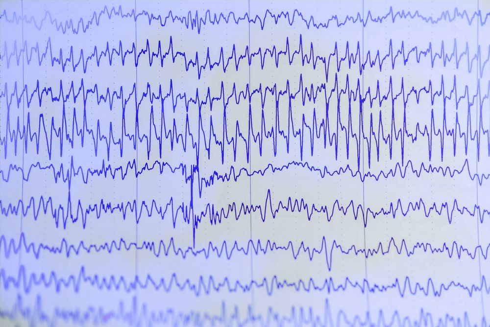 technology in neurology