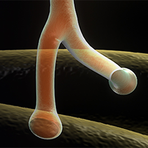 Dystrophin Pathway and Treatments Offer Hope for Patients with Duchenne Muscular Dystrophy