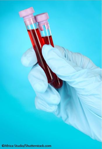 sickle cell, stroke