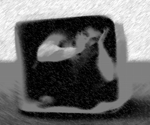 malingering epilepsy