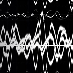 What You Need to Know About Cannabidiol for Rare Forms of Epilepsy