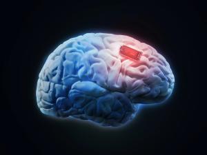 Refractory Tourette Syndrome