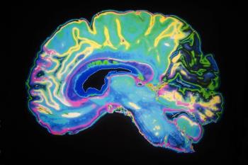concussion