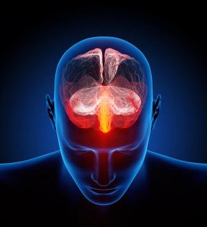 Noninvasive Vagus Nerve Stimulation for Migraine 