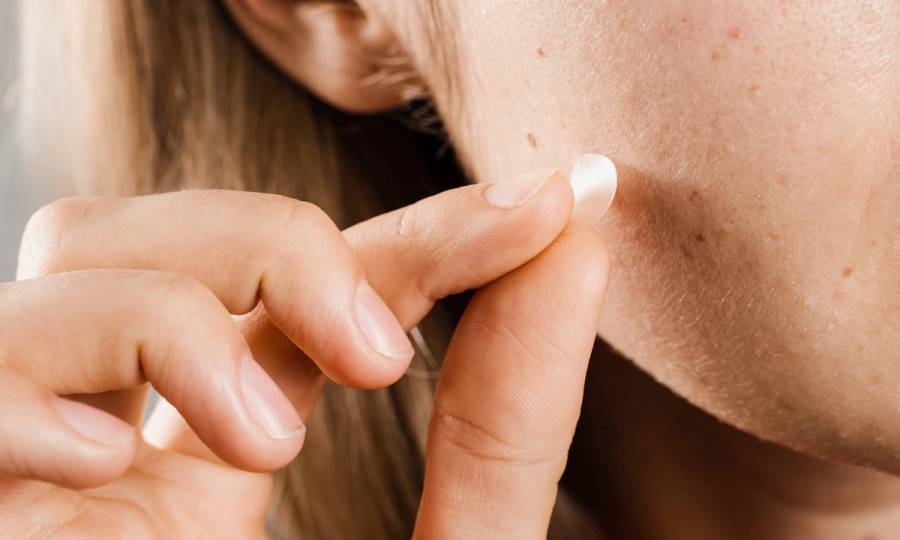pimple patch acne