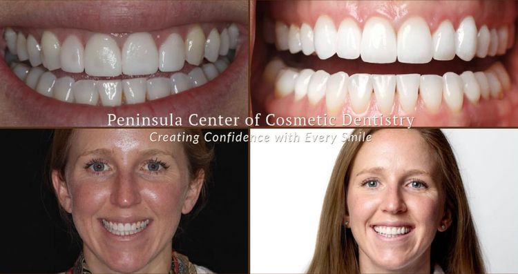 The Smile Makeover Revision