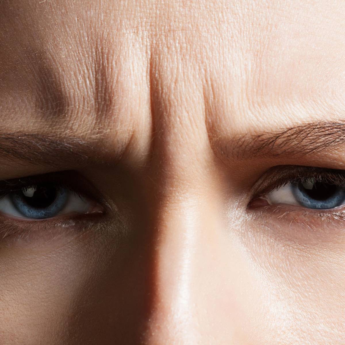 wrinklesforehead