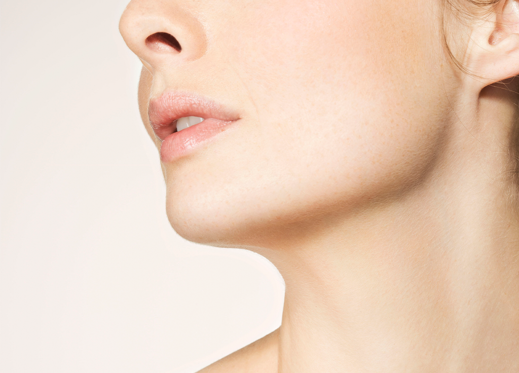 It’s Official: The Necklift Is Having a Moment