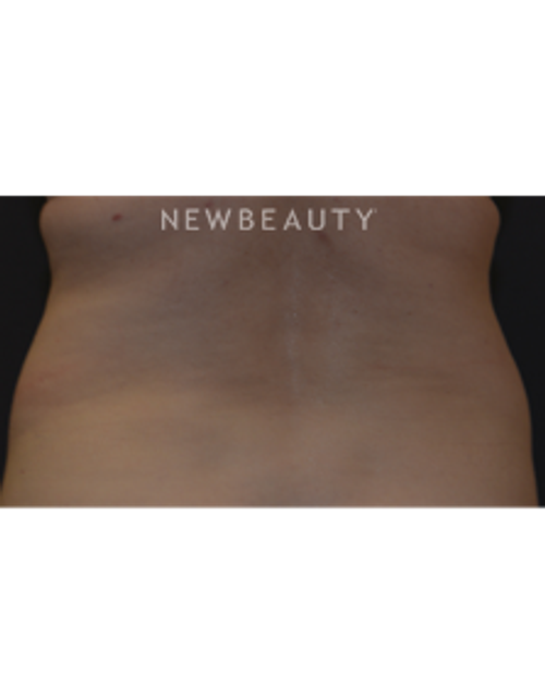 Dr. Janet Allenby - Feminine Curves - Before