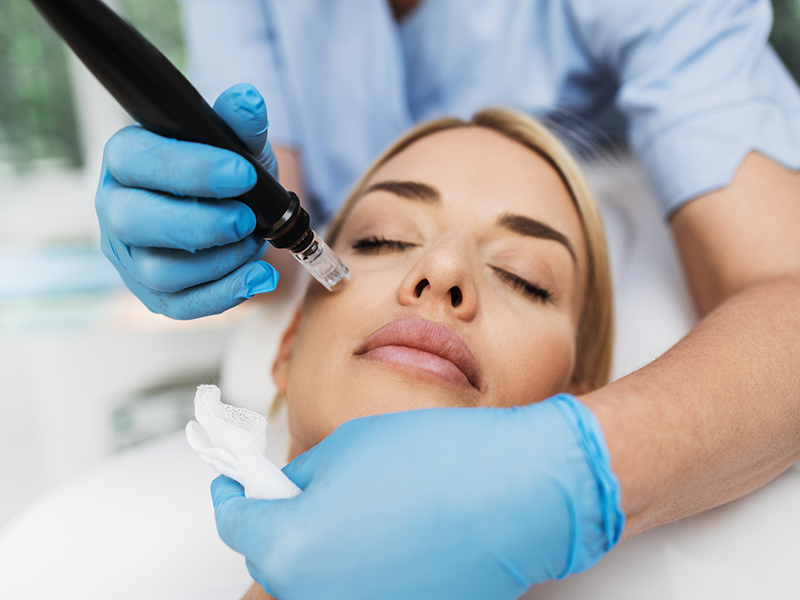 How This Treatment-Enhancing Serum Helped Give Me the Best Results