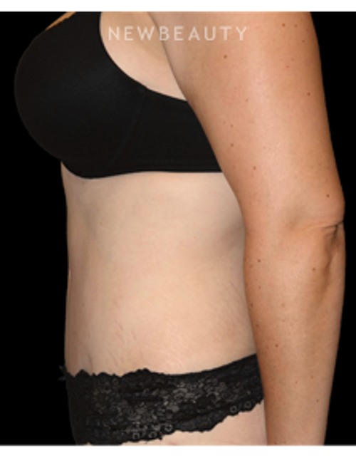 Dr. Bryan W. Gawley - Sculpted Silhouette - After