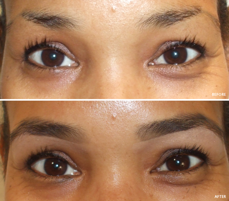 Billion Dollar Brows Brow Boost