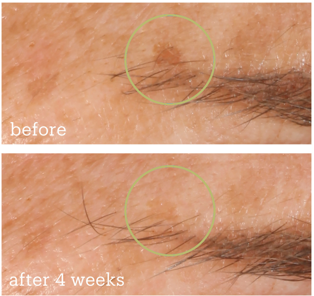 skinfix resurface brightening boost