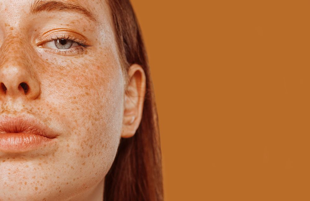 Acne Mistakes: Derms Say This Is the Number-One Mistake Acne Patients Make