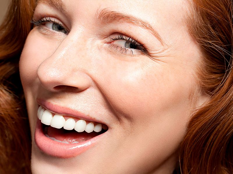 A New, First-of-Its-Kind Filler for the Cheeks Is Coming This Summer