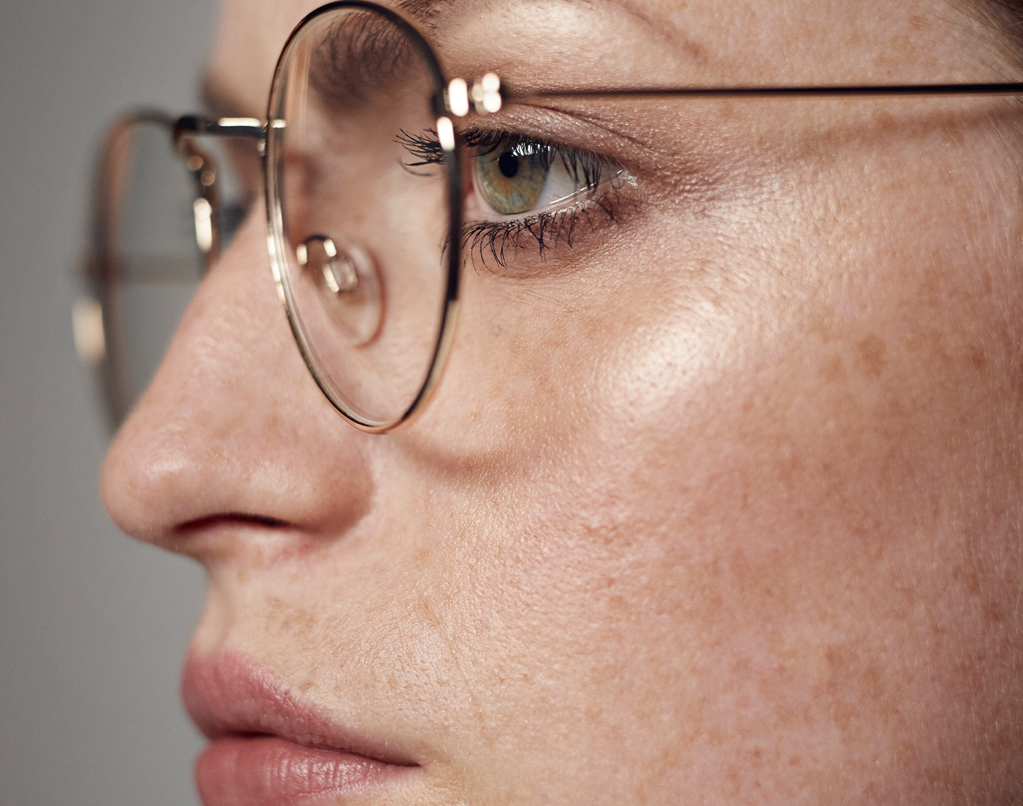 Are We Over-Filling the Under-Eye Area?