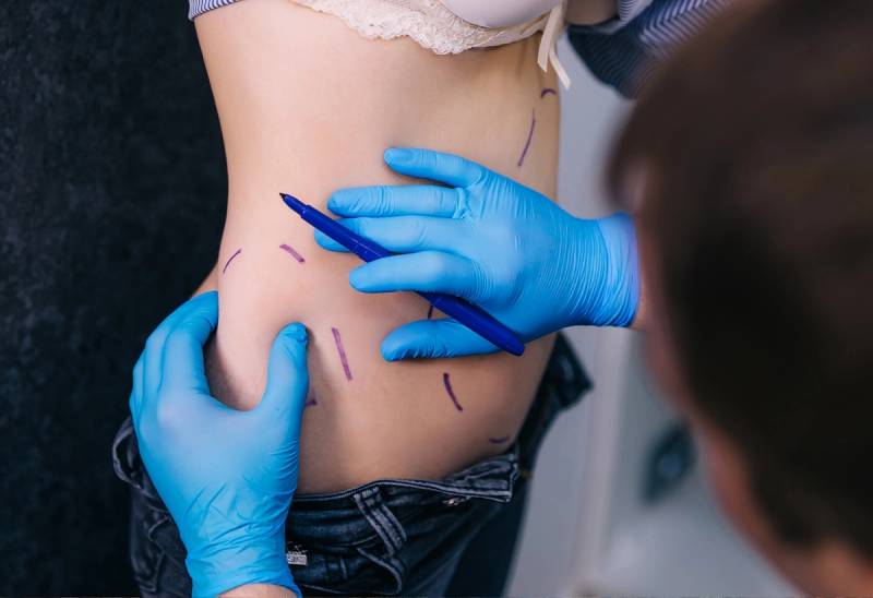 Ohio Plastic Surgeon’s License Revoked for Livestreaming Procedures and Patient Complications